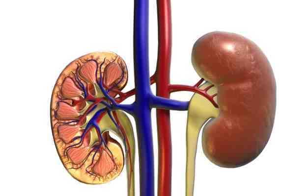 kidney failure